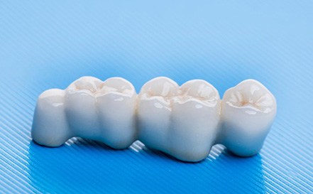 A dental bridge on a table 