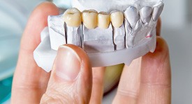 A model of a traditional dental bridge in San Antonio 