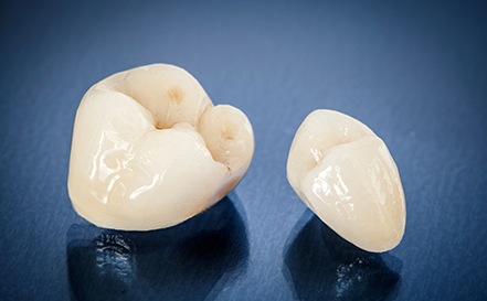 a patient admiring her new CEREC same-day crown