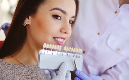 Woman's smile compared with cosmetic dental bonding color options