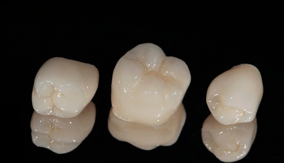 dental crowns