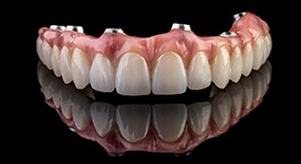 Implant denture for upper arch on dark reflective surface