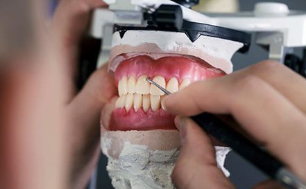 Dental lab technician working on dentures