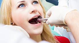 Factors that affect the cost of tooth extractions include the location of the tooth