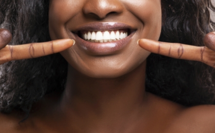 Woman pointing to smile after scaling and root planing