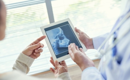 Dentist looking at digital x-rays to craft nightguards for bruxism