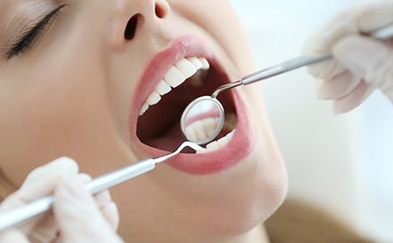 Woman having cleaning and checkup